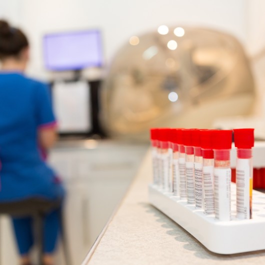 Test complet des IST